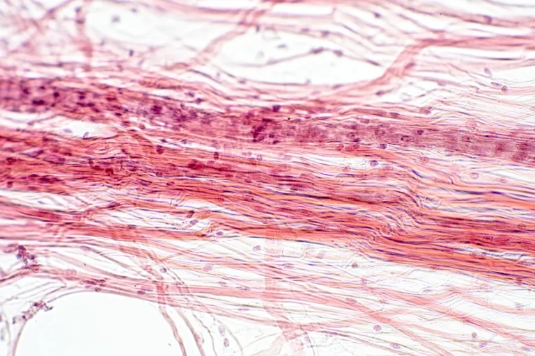 Microscope image of areolar connective tissue, part of the superficial fascia layer