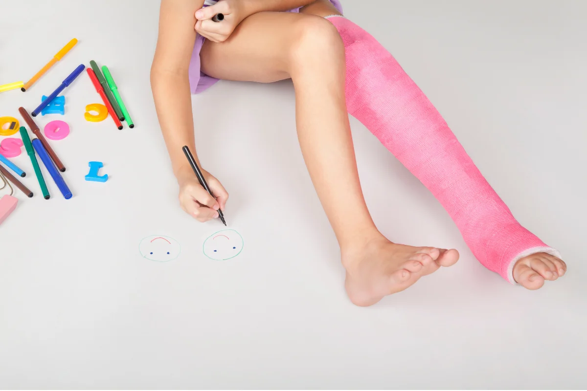 Child in a leg cast drawing with markers after a childhood injury
